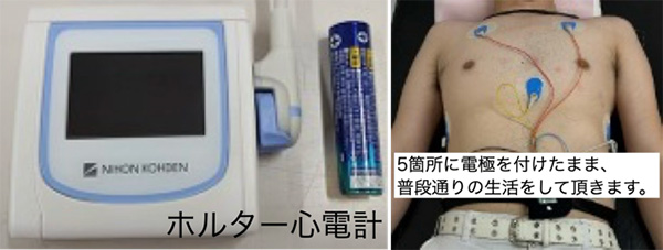 ホルター心電図検査