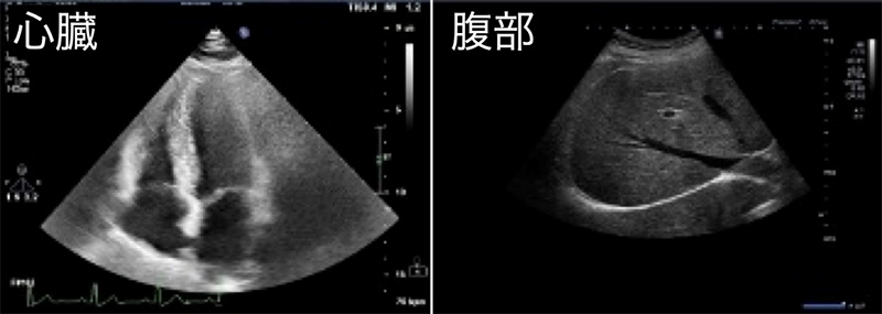 超音波検査