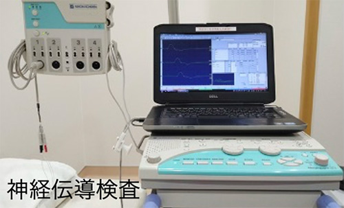 神経伝導検査