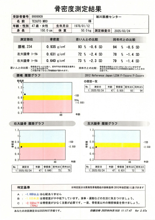 骨密度の検査結果